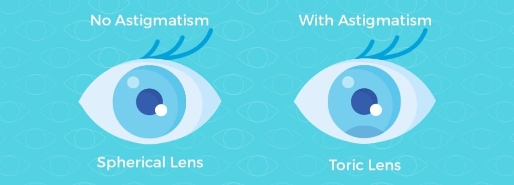 contact lenses for astigmatism